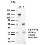 SDS-PAGE - Anti-p16INK4a Antibody [CDKN2A/7081R] (A277955) - Antibodies.com