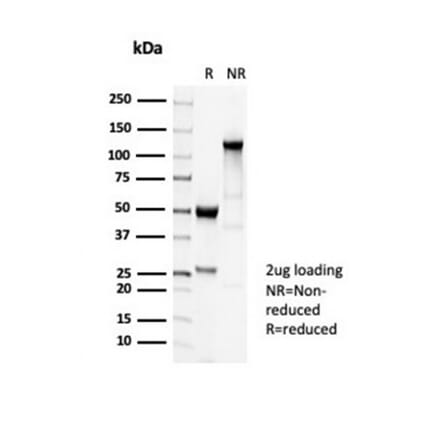 SDS-PAGE - Anti-beta III Tubulin Antibody [TUBB3/7089R] (A277956) - Antibodies.com