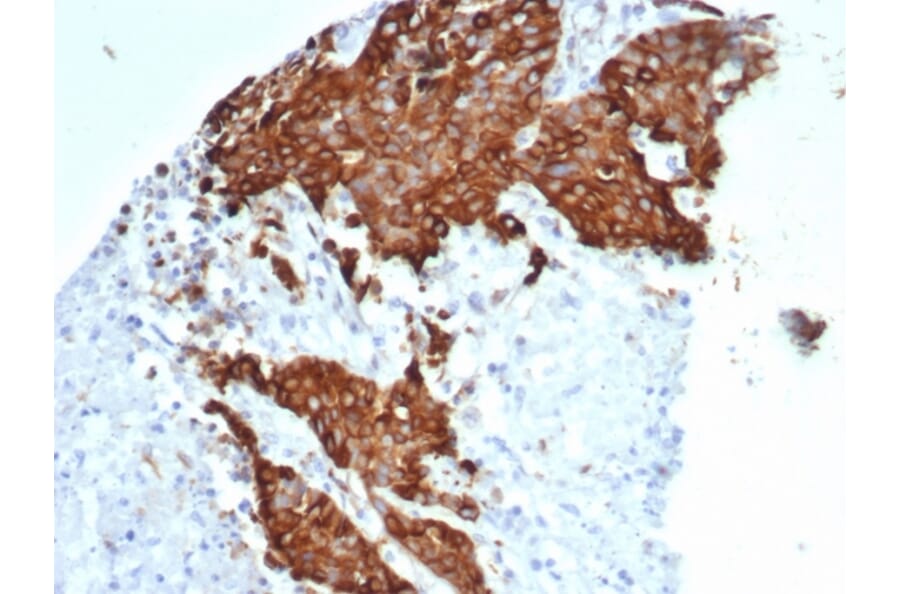 Immunohistochemistry - Anti-beta III Tubulin Antibody [TUBB3/7089R] (A277956) - Antibodies.com