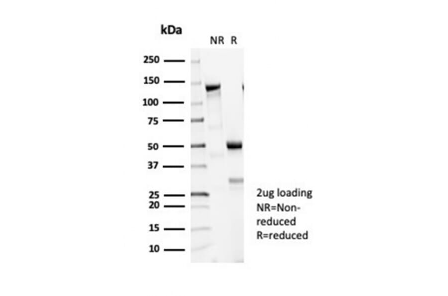 SDS-PAGE - Anti-beta III Tubulin Antibody [TUBB3/7090R] (A277957) - Antibodies.com