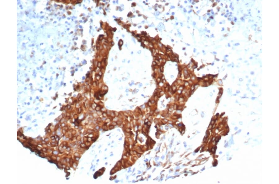 Immunohistochemistry - Anti-beta III Tubulin Antibody [TUBB3/7090R] (A277957) - Antibodies.com