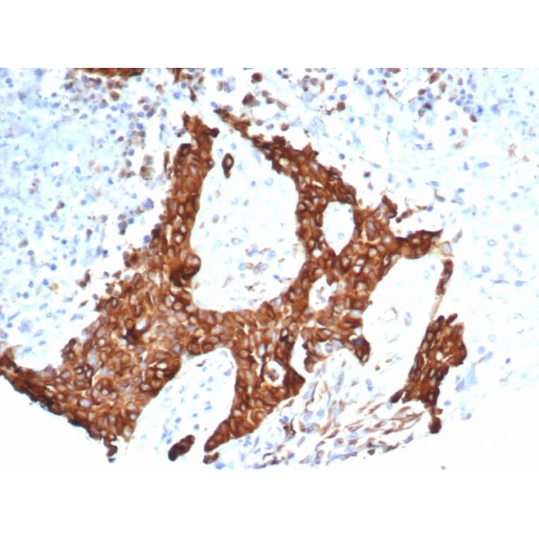 Immunohistochemistry - Anti-beta III Tubulin Antibody [TUBB3/7090R] (A277957) - Antibodies.com