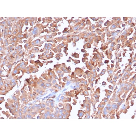 Immunohistochemistry - Anti-Carcinoembryonic Antigen Antibody [C66/6470R] (A277958) - Antibodies.com