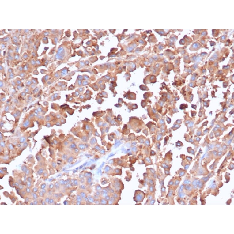 Immunohistochemistry - Anti-Carcinoembryonic Antigen Antibody [C66/6470R] (A277958) - Antibodies.com