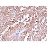 Immunohistochemistry - Anti-Carcinoembryonic Antigen Antibody [C66/6470R] (A277958) - Antibodies.com