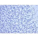 Immunohistochemistry - Anti-Carcinoembryonic Antigen Antibody [C66/6470R] (A277958) - Antibodies.com
