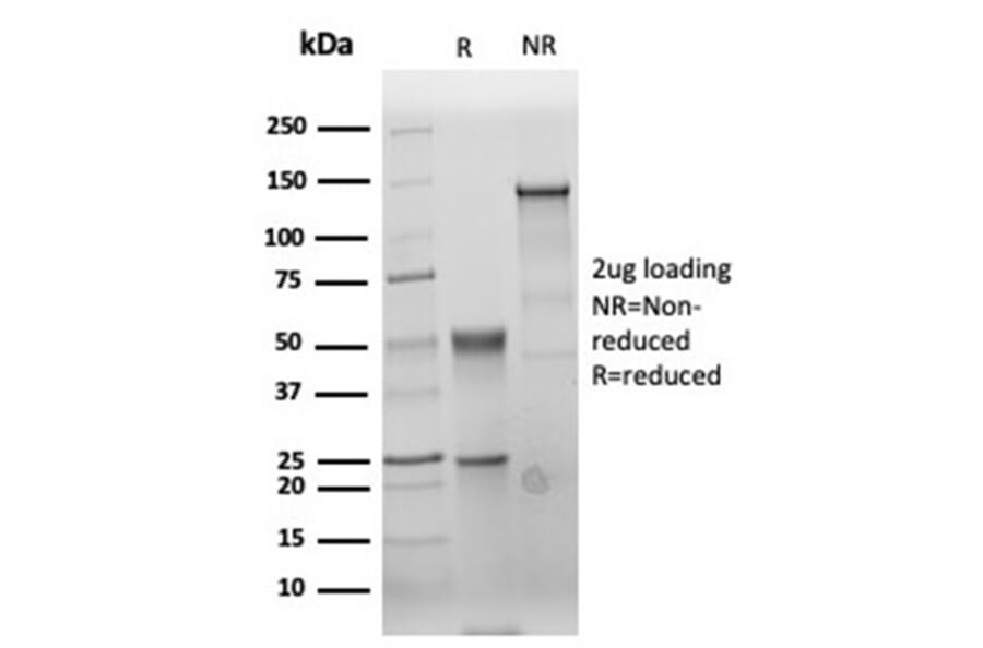 SDS-PAGE - Anti-Carcinoembryonic Antigen Antibody [C66/6470R] (A277958) - Antibodies.com