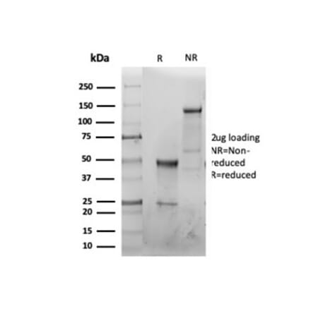 SDS-PAGE - Anti-CFTR Antibody [CFTR/6477R] (A277959) - Antibodies.com