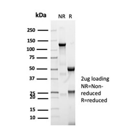 SDS-PAGE - Anti-CFTR Antibody [CFTR/7003R] (A277960) - Antibodies.com