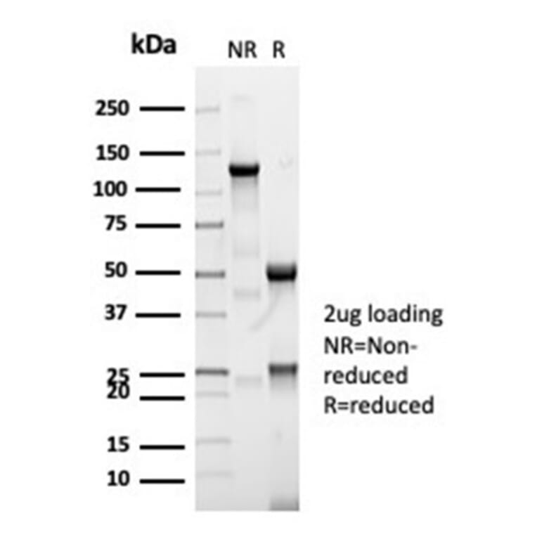 SDS-PAGE - Anti-CFTR Antibody [CFTR/7003R] (A277960) - Antibodies.com