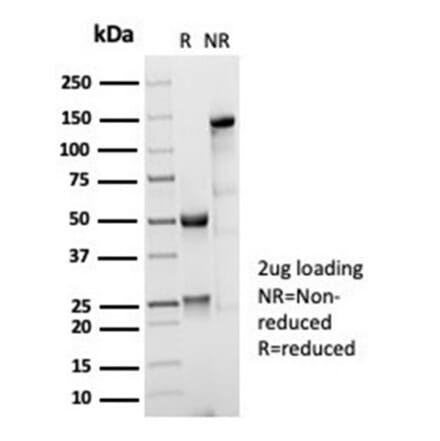 SDS-PAGE - Anti-CD35 Antibody [CR1/7016R] (A277963) - Antibodies.com