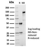 SDS-PAGE - Anti-CD35 Antibody [CR1/7016R] (A277963) - Antibodies.com