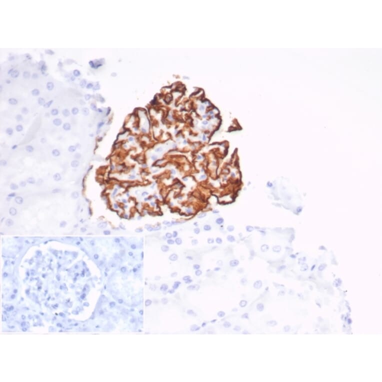 Immunohistochemistry - Anti-CD35 Antibody [CR1/7016R] (A277963) - Antibodies.com