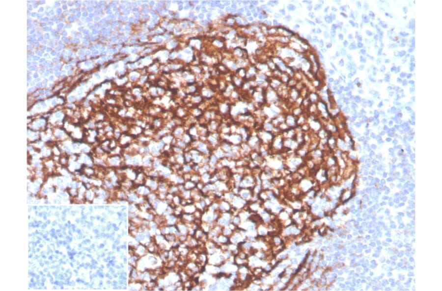 Immunohistochemistry - Anti-CD21 Antibody [CR2/3990R] (A277964) - Antibodies.com