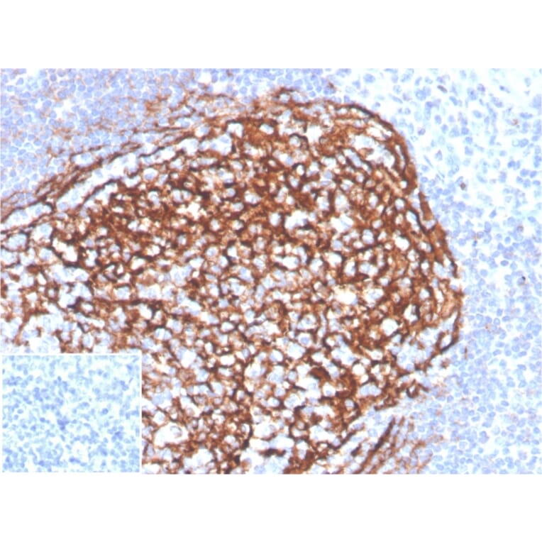 Immunohistochemistry - Anti-CD21 Antibody [CR2/3990R] (A277964) - Antibodies.com