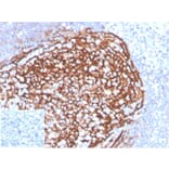 Immunohistochemistry - Anti-CD21 Antibody [CR2/3990R] (A277964) - Antibodies.com