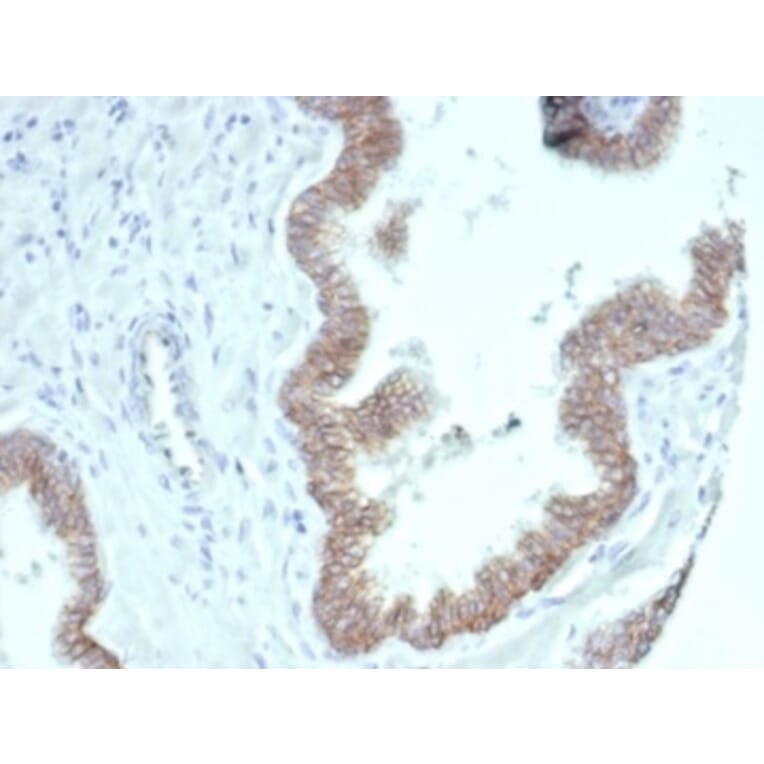 Immunohistochemistry - Anti-beta Catenin Antibody [CTNNB1/7044R] (A277968) - Antibodies.com