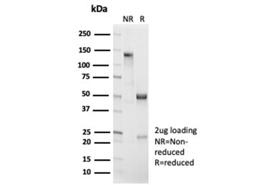 SDS-PAGE - Anti-beta Catenin Antibody [CTNNB1/7044R] (A277968) - Antibodies.com