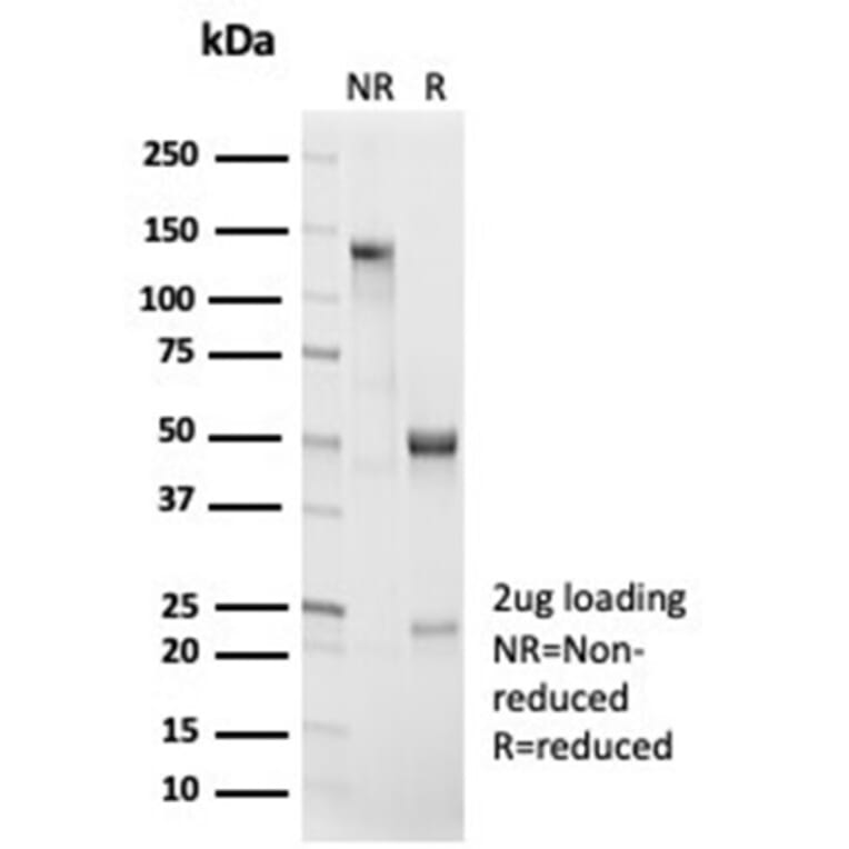 SDS-PAGE - Anti-beta Catenin Antibody [CTNNB1/7044R] (A277968) - Antibodies.com