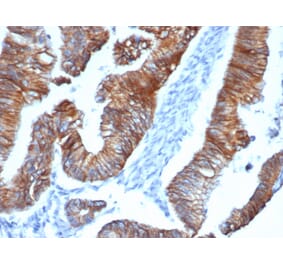 Immunohistochemistry - Anti-delta 1 Catenin Antibody [CTNND1/4383R] (A277969) - Antibodies.com