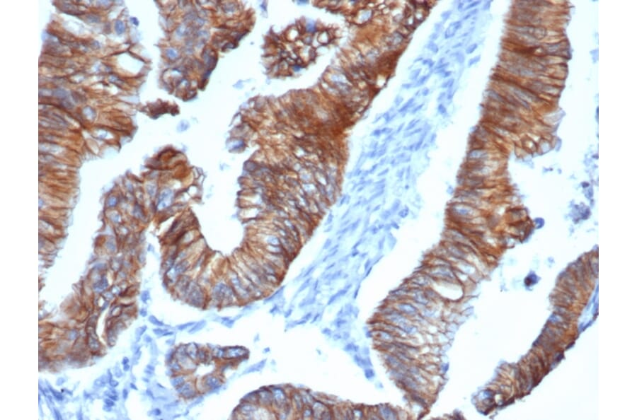 Immunohistochemistry - Anti-delta 1 Catenin Antibody [CTNND1/4383R] (A277969) - Antibodies.com