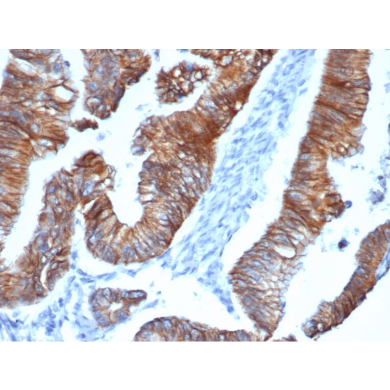 Immunohistochemistry - Anti-delta 1 Catenin Antibody [CTNND1/4383R] (A277969) - Antibodies.com