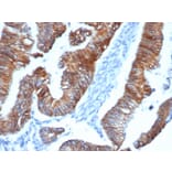 Immunohistochemistry - Anti-delta 1 Catenin Antibody [CTNND1/4383R] (A277969) - Antibodies.com
