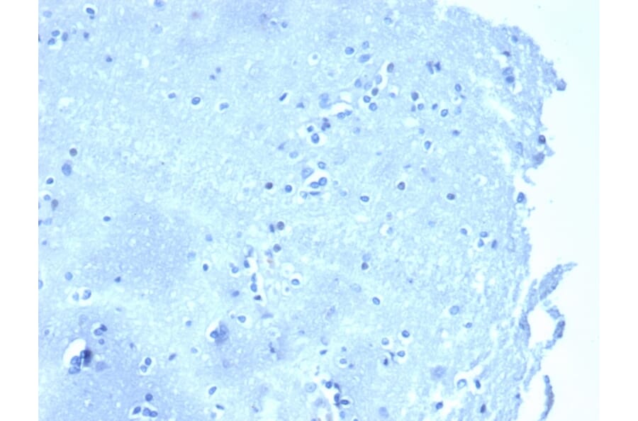 Immunohistochemistry - Anti-delta 1 Catenin Antibody [CTNND1/4383R] (A277969) - Antibodies.com