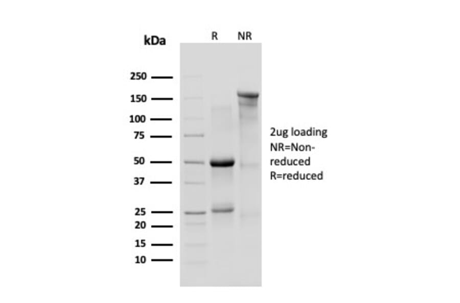 SDS-PAGE - Anti-delta 1 Catenin Antibody [CTNND1/4383R] (A277969) - Antibodies.com