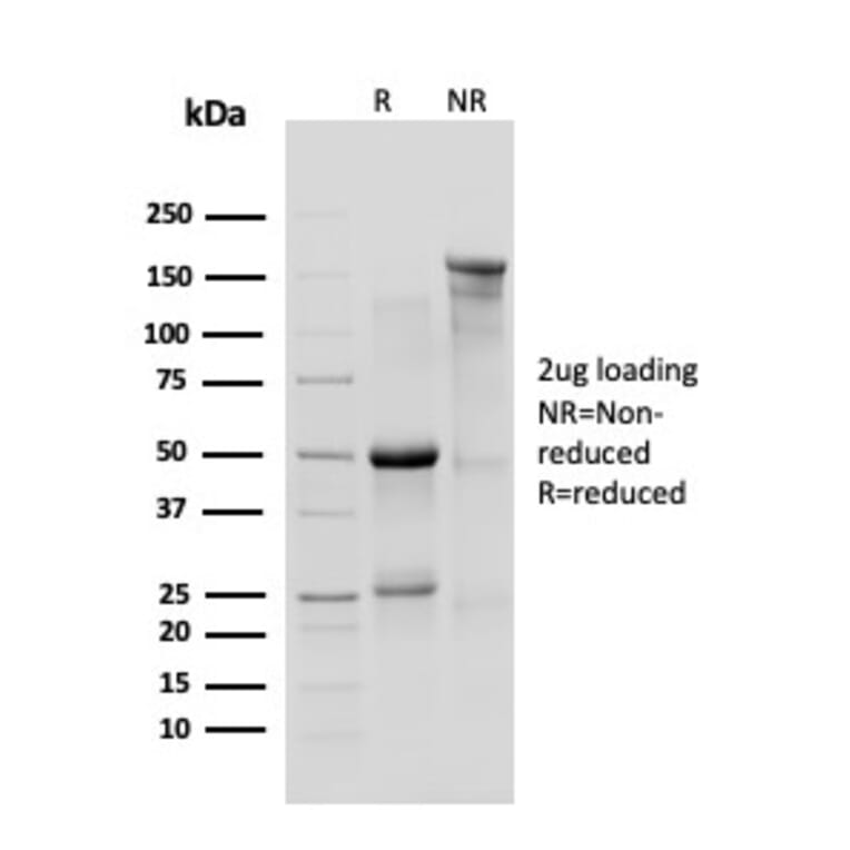SDS-PAGE - Anti-delta 1 Catenin Antibody [CTNND1/4383R] (A277969) - Antibodies.com
