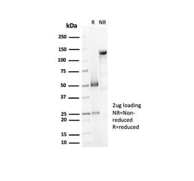 SDS-PAGE - Anti-Decorin Antibody [DCN/7031R] (A277970) - Antibodies.com