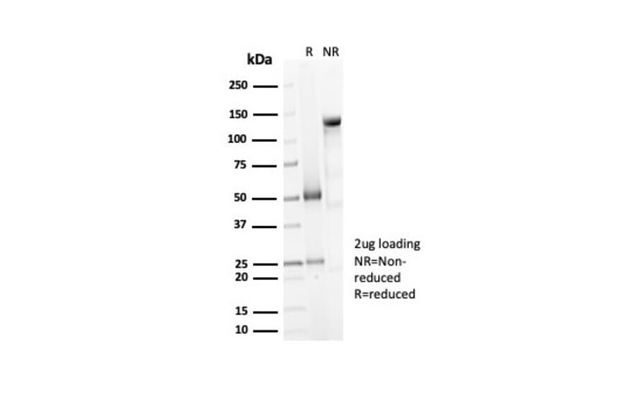 SDS-PAGE - Anti-Decorin Antibody [DCN/7031R] (A277970) - Antibodies.com