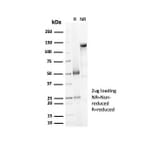 SDS-PAGE - Anti-Decorin Antibody [DCN/7031R] (A277970) - Antibodies.com
