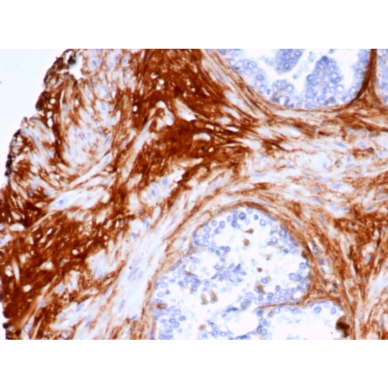 Immunohistochemistry - Anti-Decorin Antibody [DCN/7031R] (A277970) - Antibodies.com
