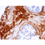 Immunohistochemistry - Anti-Decorin Antibody [DCN/7031R] (A277970) - Antibodies.com