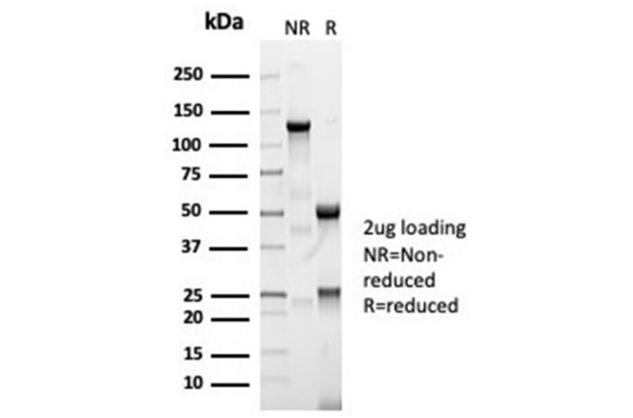 SDS-PAGE - Anti-Angiotensin Converting Enzyme 1 Antibody [ACE/7004R] (A277971) - Antibodies.com