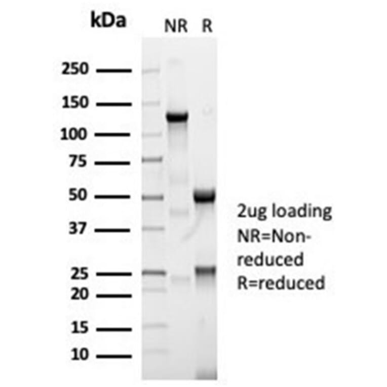 SDS-PAGE - Anti-Angiotensin Converting Enzyme 1 Antibody [ACE/7004R] (A277971) - Antibodies.com