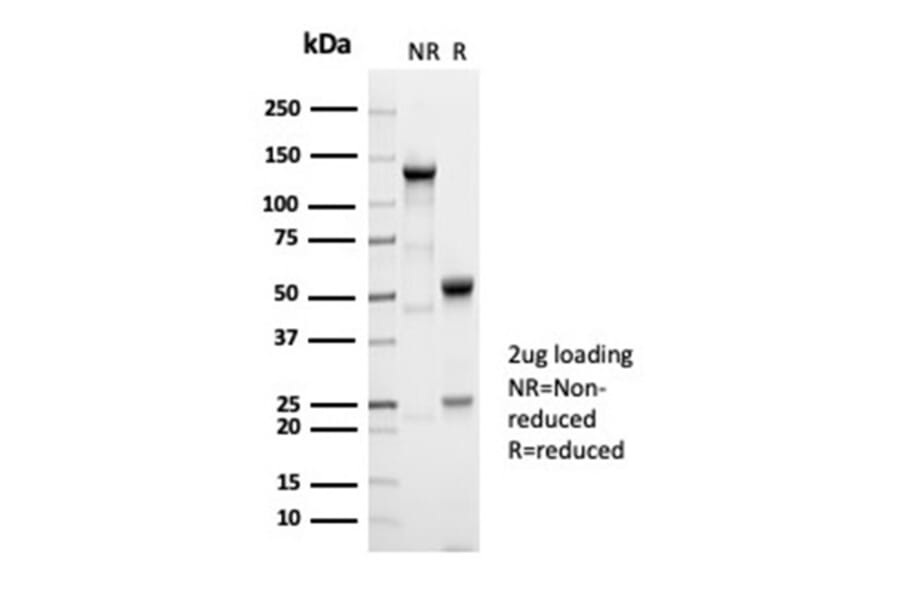 SDS-PAGE - Anti-alpha Fetoprotein Antibody [AFP/7007R] (A277972) - Antibodies.com