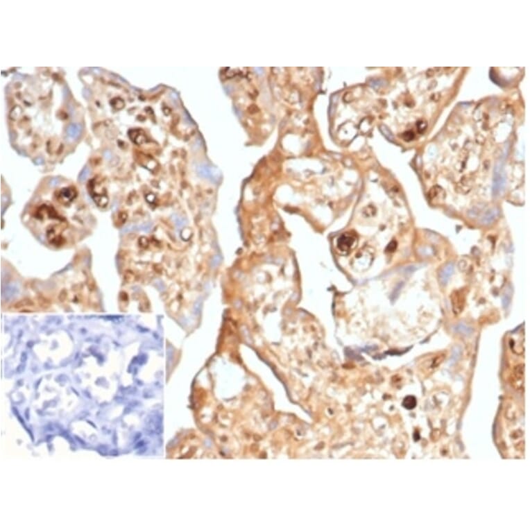 Immunohistochemistry - Anti-alpha Fetoprotein Antibody [AFP/7007R] (A277972) - Antibodies.com