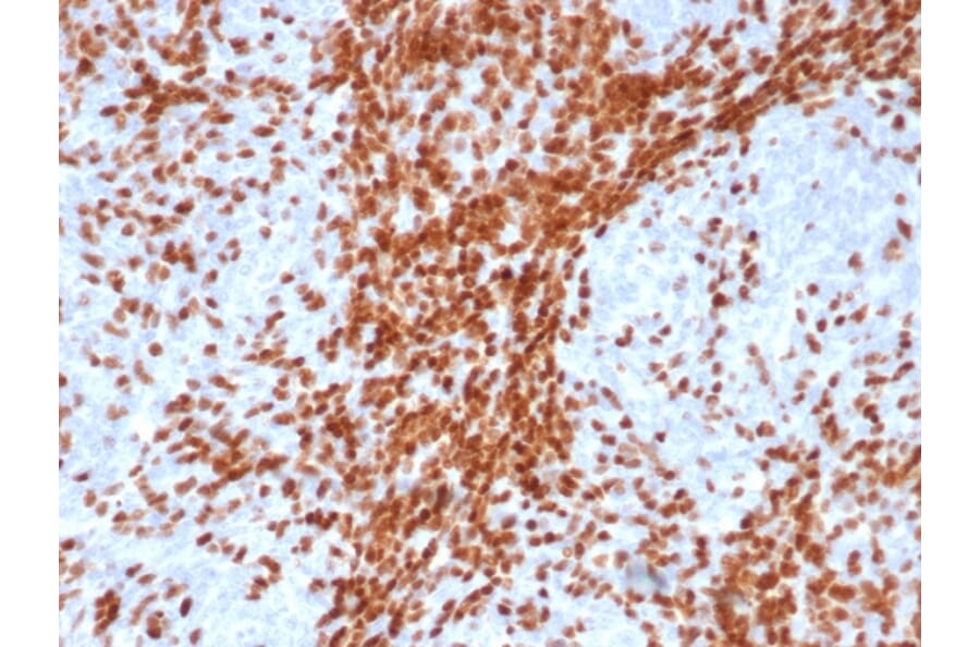 Immunohistochemistry - Anti-TdT Antibody [DNTT/4617R] (A277973) - Antibodies.com