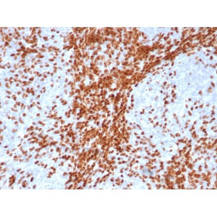 Immunohistochemistry - Anti-TdT Antibody [DNTT/4617R] (A277973) - Antibodies.com