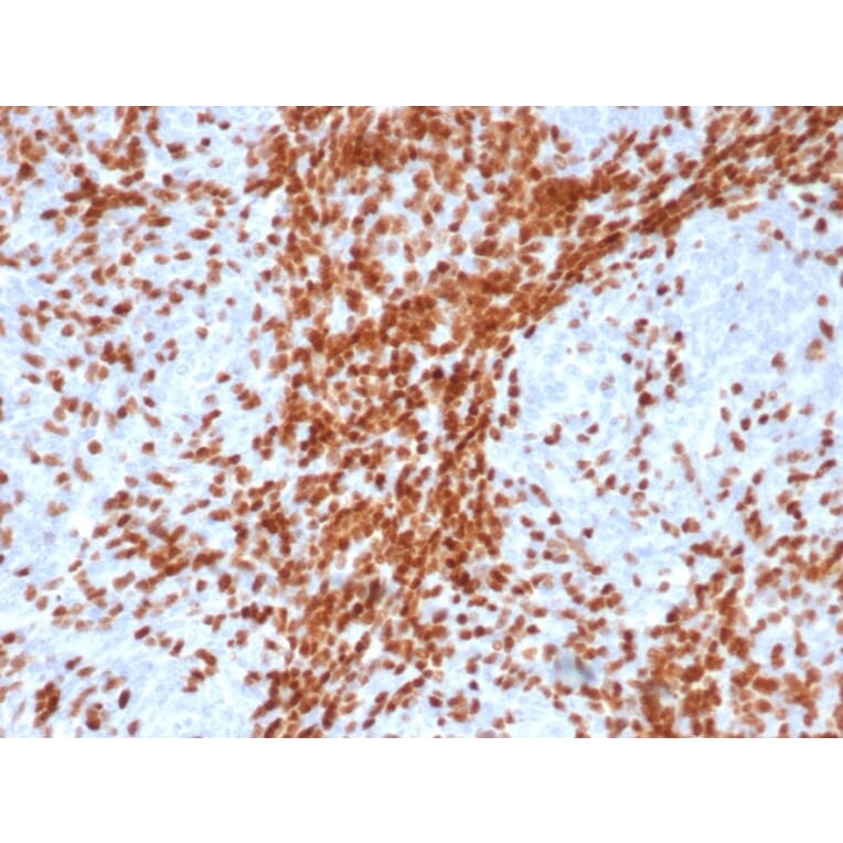 Immunohistochemistry - Anti-TdT Antibody [DNTT/4617R] (A277973) - Antibodies.com