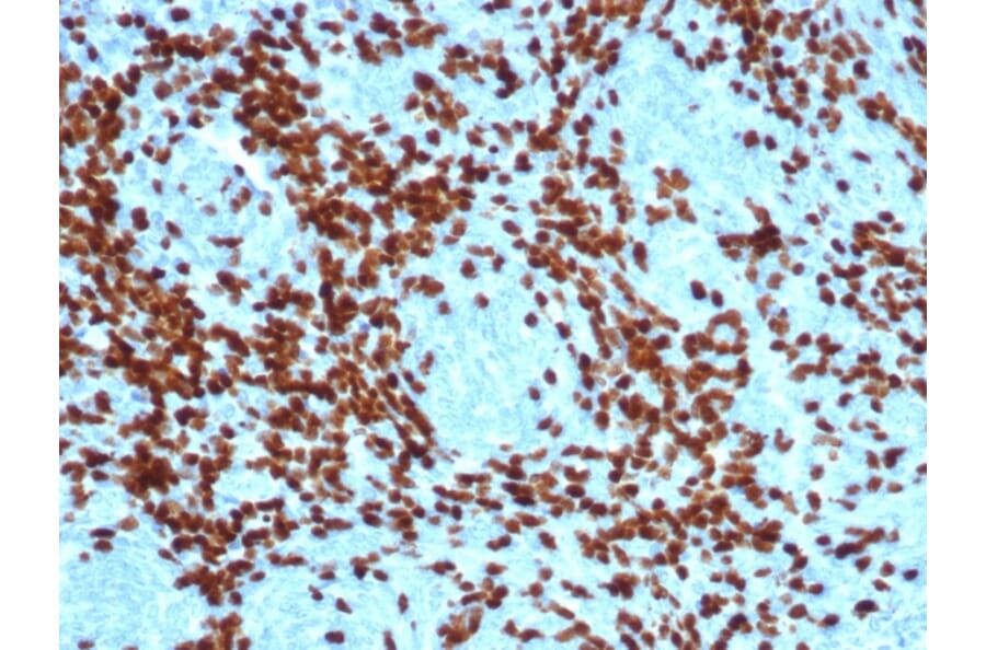 Immunohistochemistry - Anti-TdT Antibody [DNTT/4617R] (A277973) - Antibodies.com