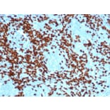 Immunohistochemistry - Anti-TdT Antibody [DNTT/4617R] (A277973) - Antibodies.com