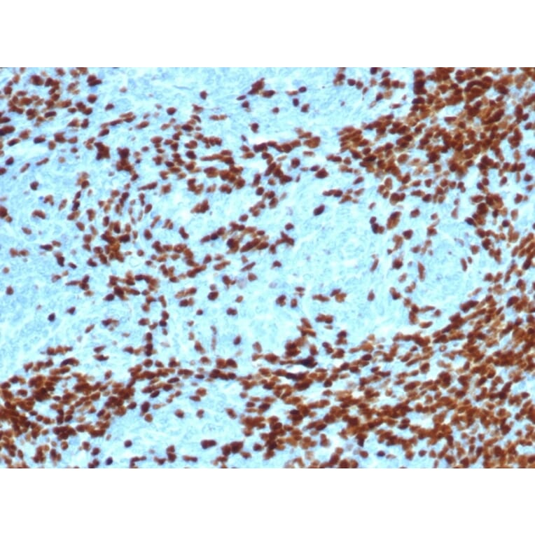 Immunohistochemistry - Anti-TdT Antibody [DNTT/4617R] (A277973) - Antibodies.com