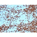 Immunohistochemistry - Anti-TdT Antibody [DNTT/4617R] (A277973) - Antibodies.com