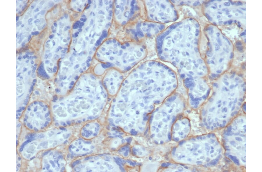 Immunohistochemistry - Anti-EGFR Antibody [EGFR/6390R] (A277974) - Antibodies.com
