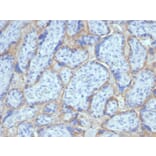 Immunohistochemistry - Anti-EGFR Antibody [EGFR/6390R] (A277974) - Antibodies.com
