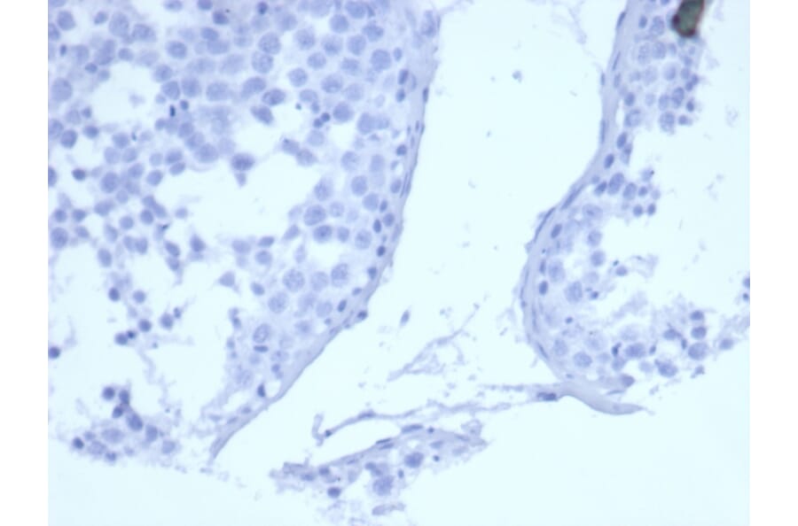 Immunohistochemistry - Anti-EGFR Antibody [EGFR/6390R] (A277974) - Antibodies.com