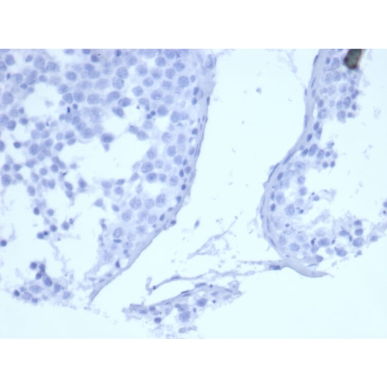 Immunohistochemistry - Anti-EGFR Antibody [EGFR/6390R] (A277974) - Antibodies.com